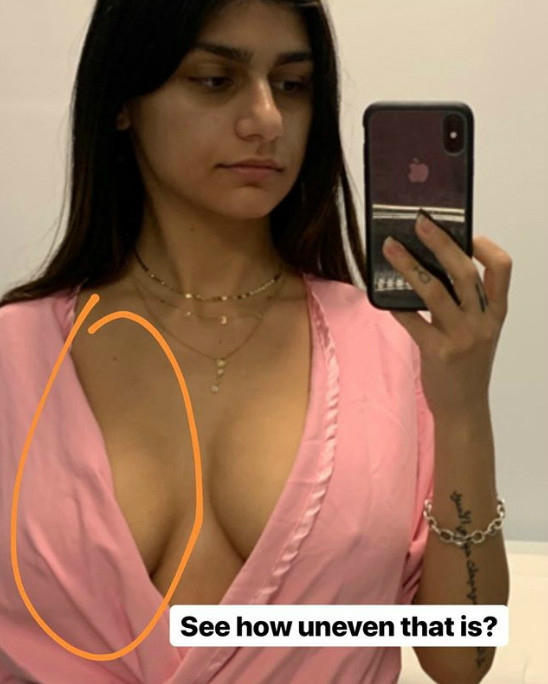charmaine skinner recommends Mia Khalifa Breast Implants