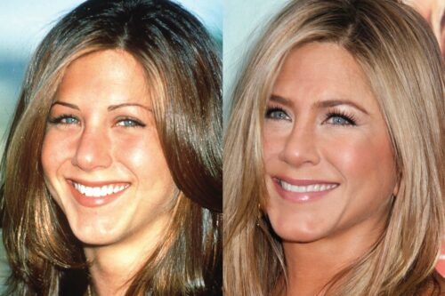 Does Jennifer Aniston Have Fake Boobs travel packages