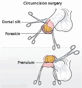 carol ting recommends how to masturbate uncircumcised pic