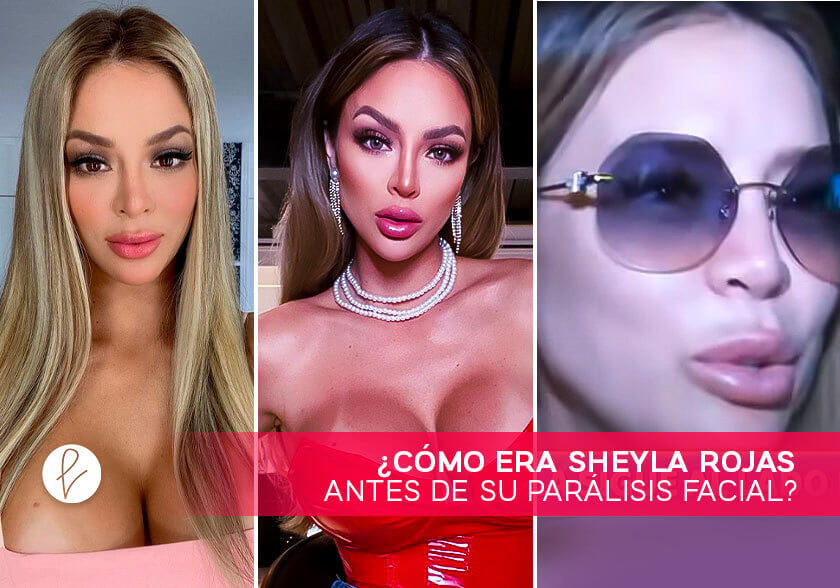 donn simmons recommends sheyla rojas antes y despues pic