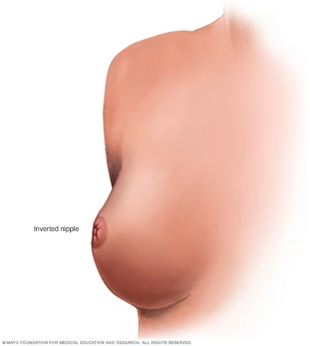 dhruv bisht add big boobs inverted nipples photo