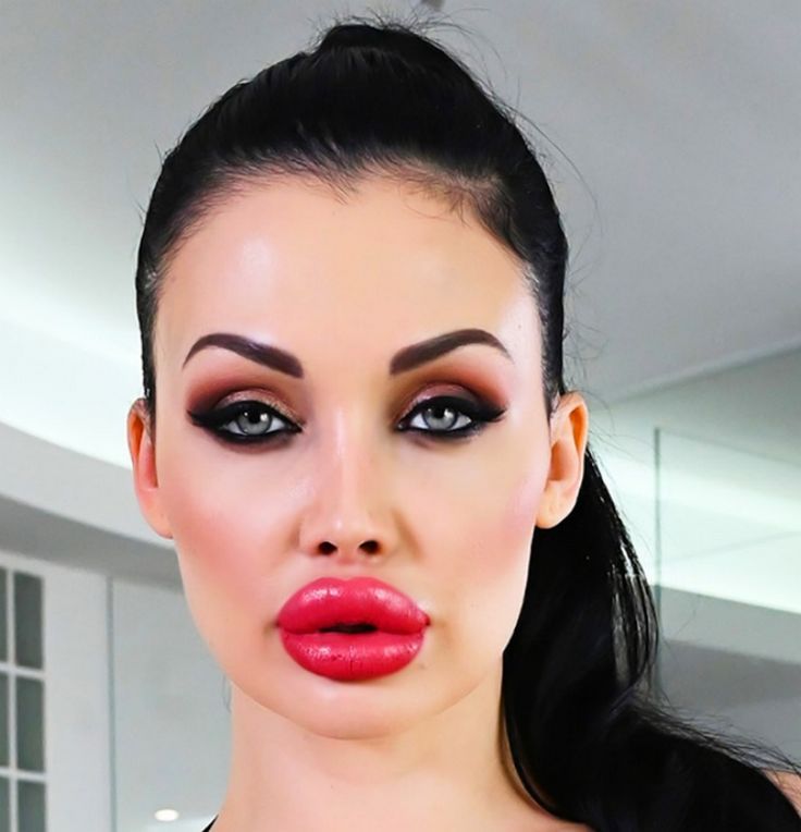 blaine anthony hill recommends Aletta Ocean Plastic Surgery