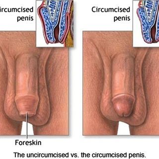 christopher kempe recommends How To Masturbate Uncircumcised