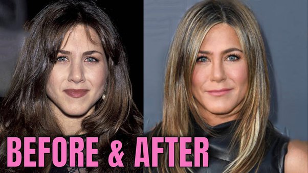 allan cruzado recommends Does Jennifer Aniston Have Fake Boobs