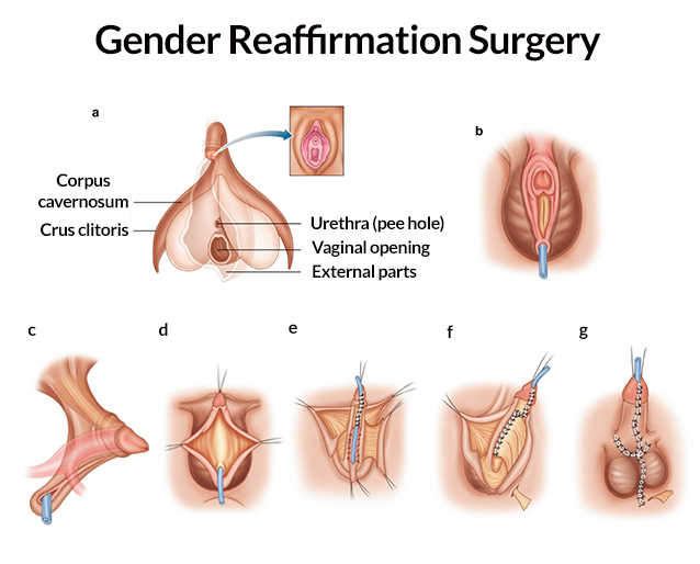 danielle husbands recommends post op mtf pics pic