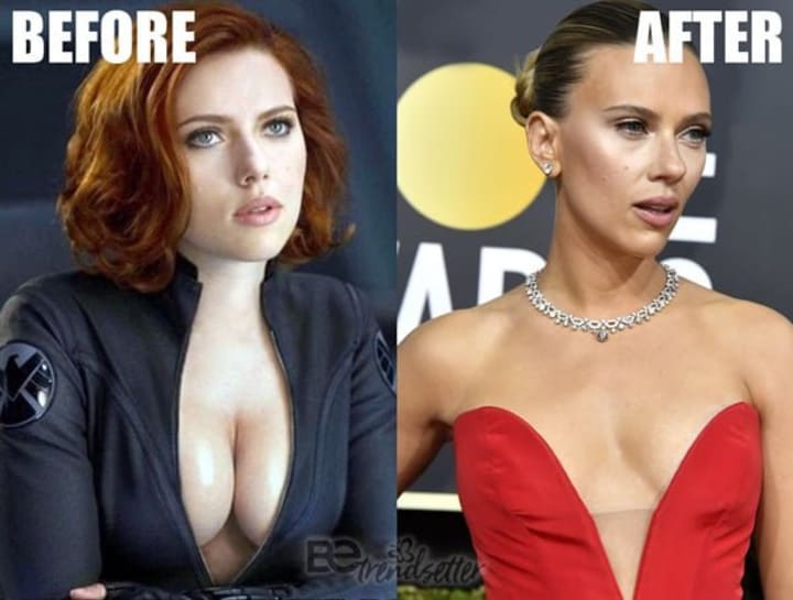 does scarlett johansson have fake boobs