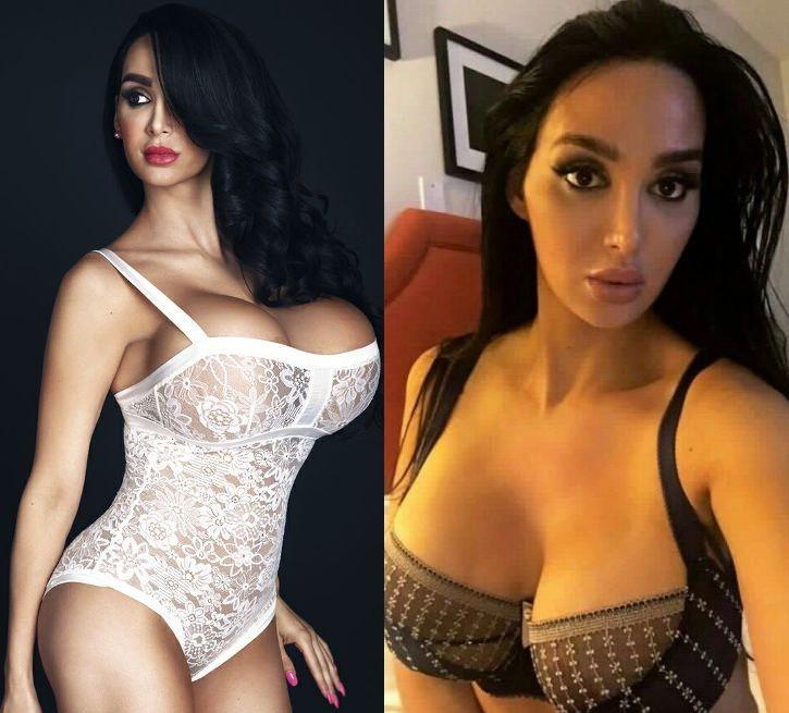 daniella watkins recommends amy anderssen before implants pic