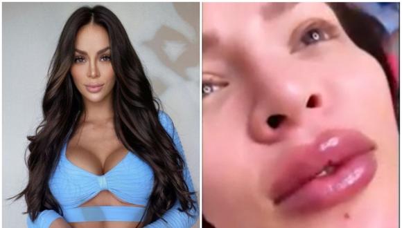 della aja recommends sheyla rojas antes y despues pic