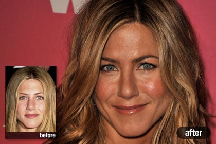 bradley wells recommends does jennifer aniston have fake boobs pic