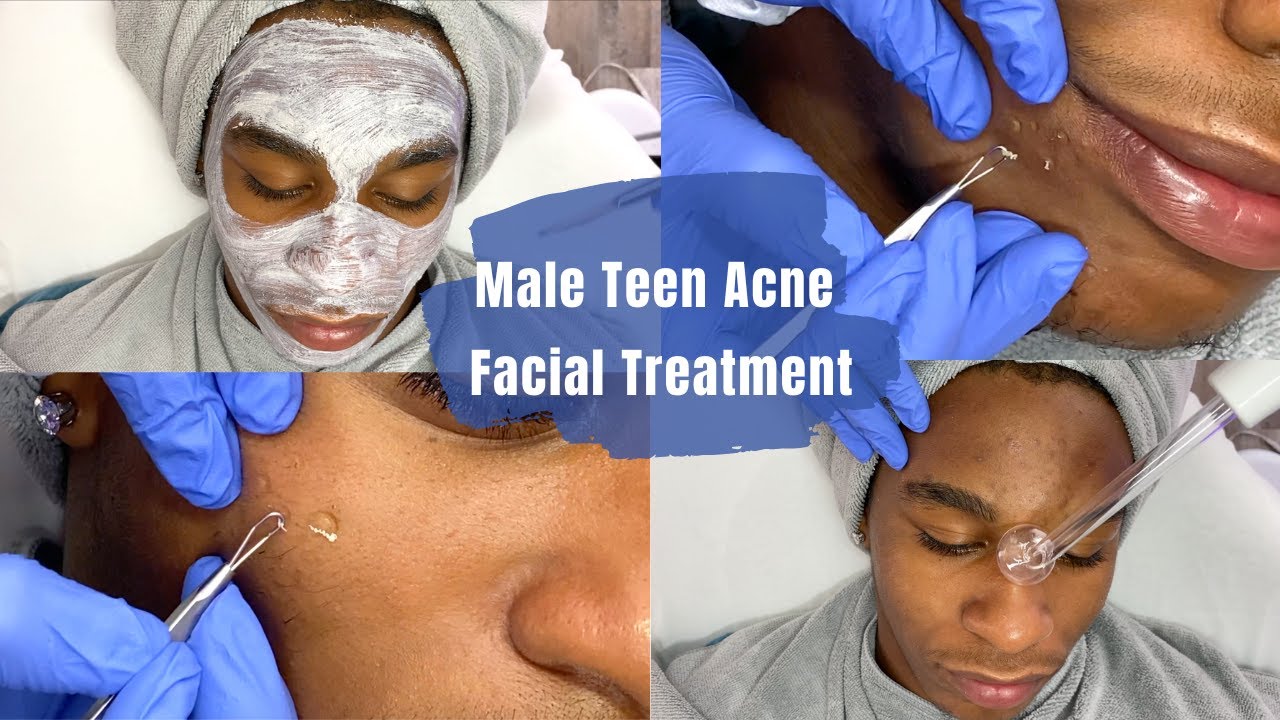 demetrius lindsey recommends Teen Facials Videos