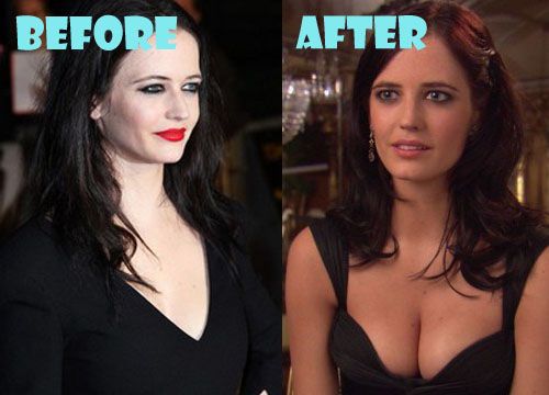 cheryl camper recommends Eva Green Breast Implants