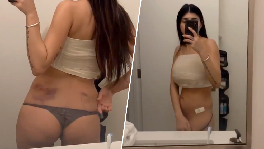 mia khalifa pre surgery