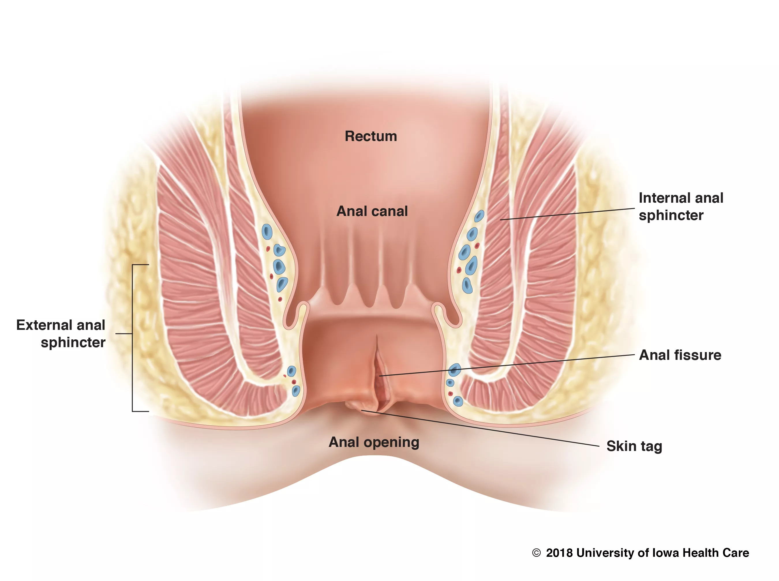 aakil gagneja add teen forced painful anal photo