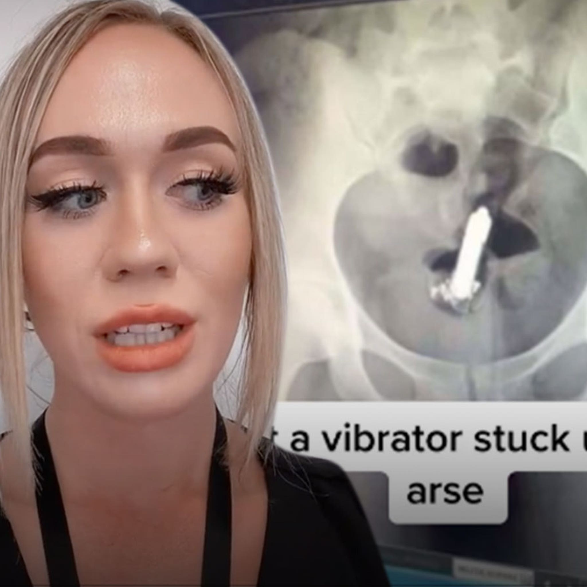 vibrator stuck in ass