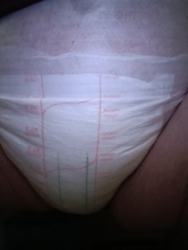 Abdl Diaper Change Tumblr melissa manning