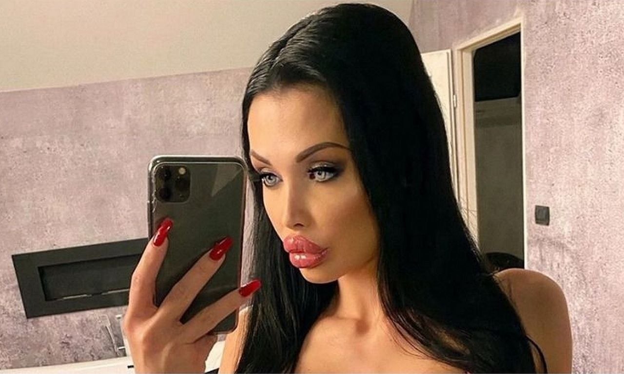 becky boyce recommends aletta ocean plastic surgery pic
