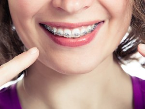 casey zeller recommends Can You Give Oral Sex With Braces