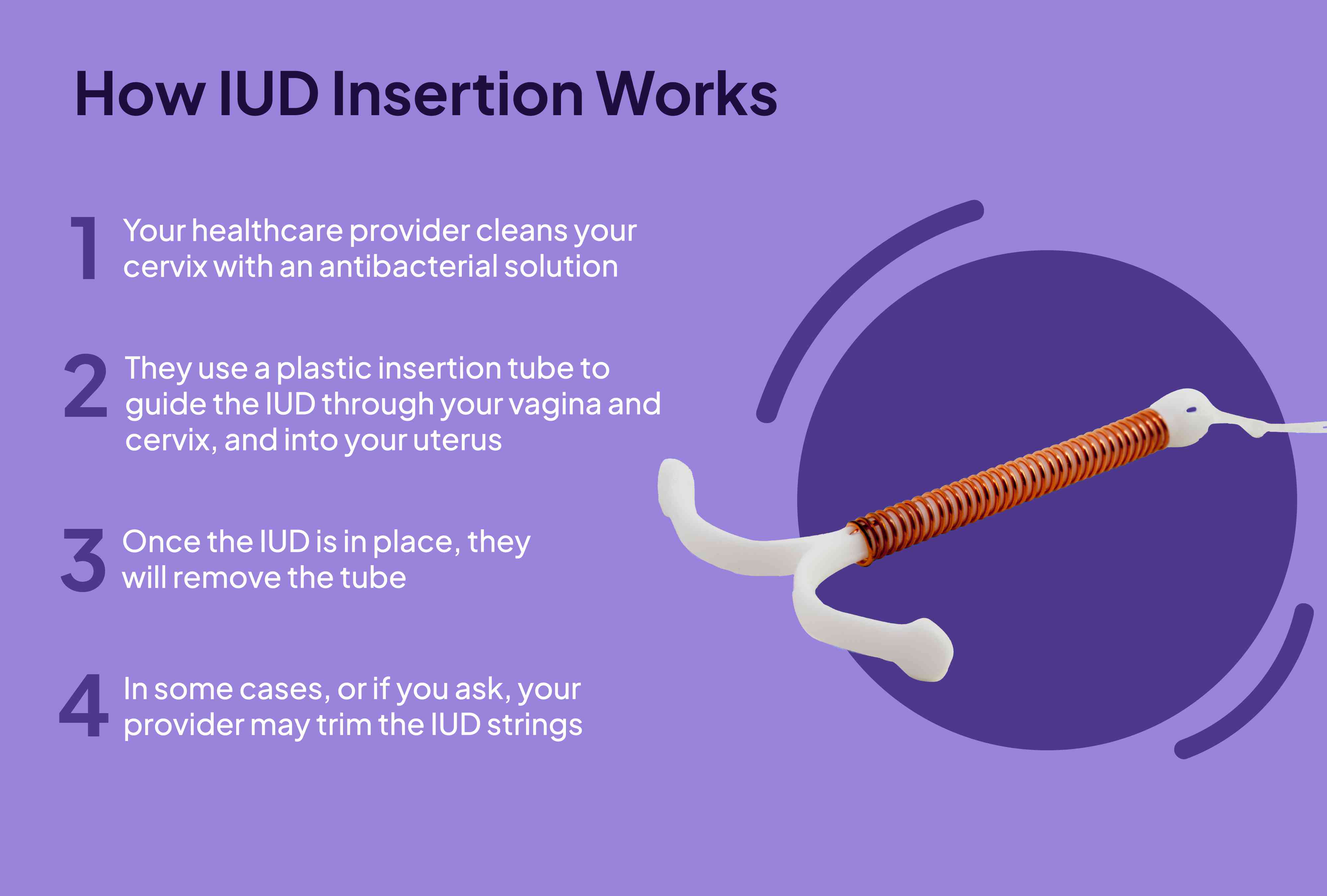 can you squirt with an iud in
