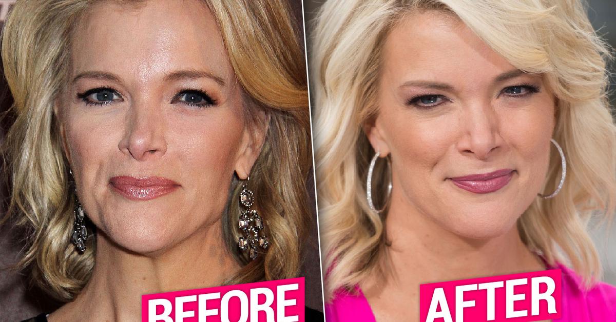 megyn kelly nipple slip