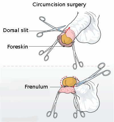 how to masturbate uncircumcised