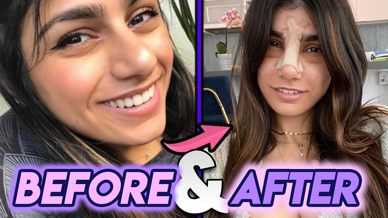 daryl symmons add photo mia khalifa pre surgery