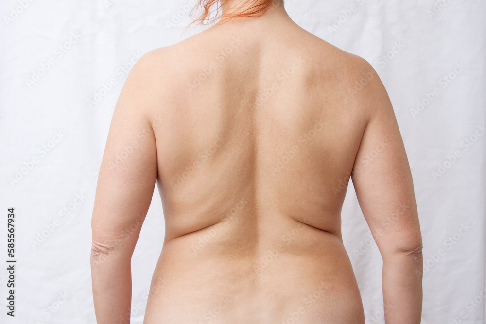 craig parkes share nude fat woman photos
