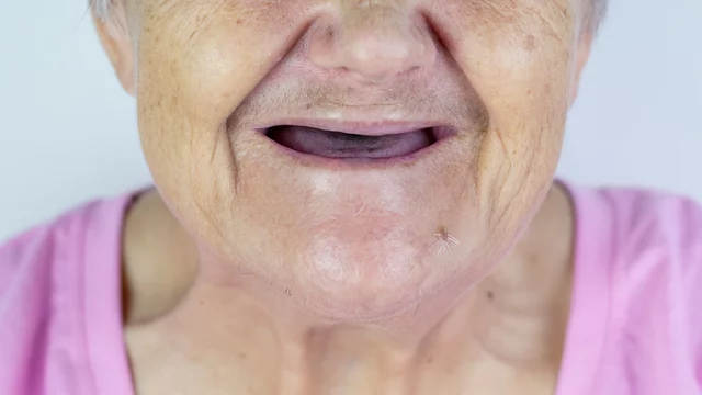 dawn marie spencer recommends old lady with no teeth pic
