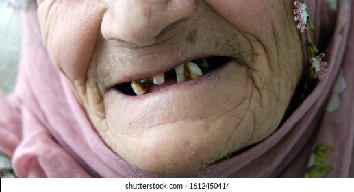 Best of Old lady with no teeth