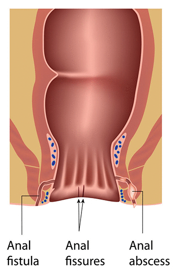 david winship recommends put it in my booty hole pic