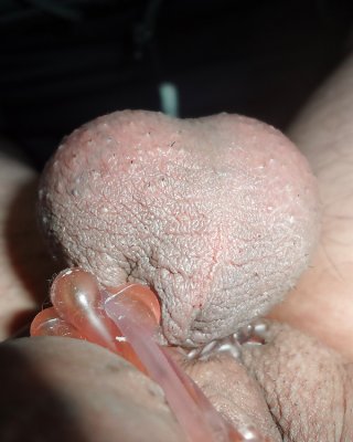 anna farhan add photo urethra insertion porn